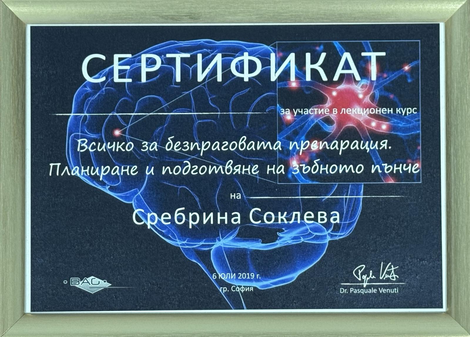 Безпрагова препарация
