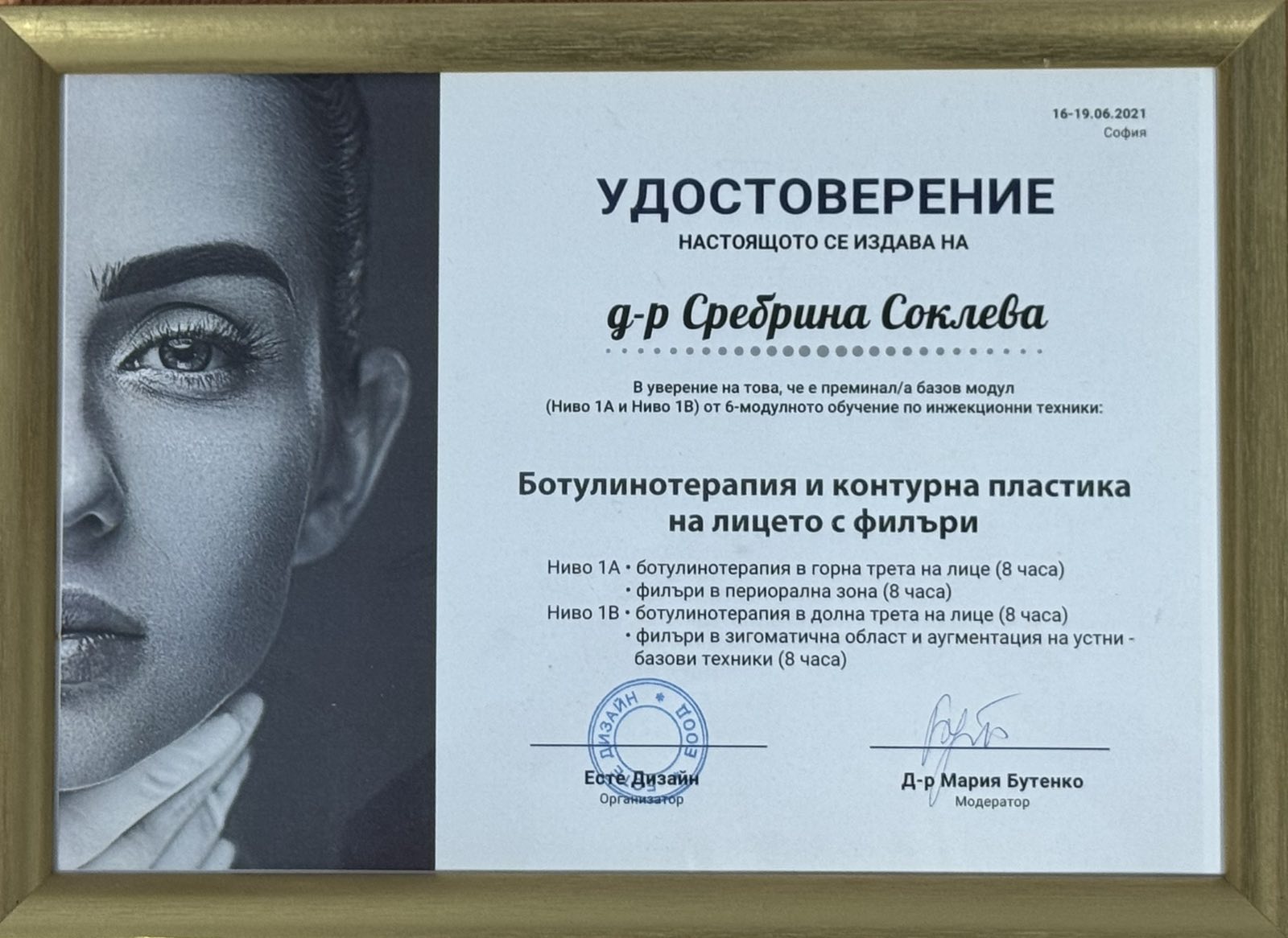 Ботулинов филър