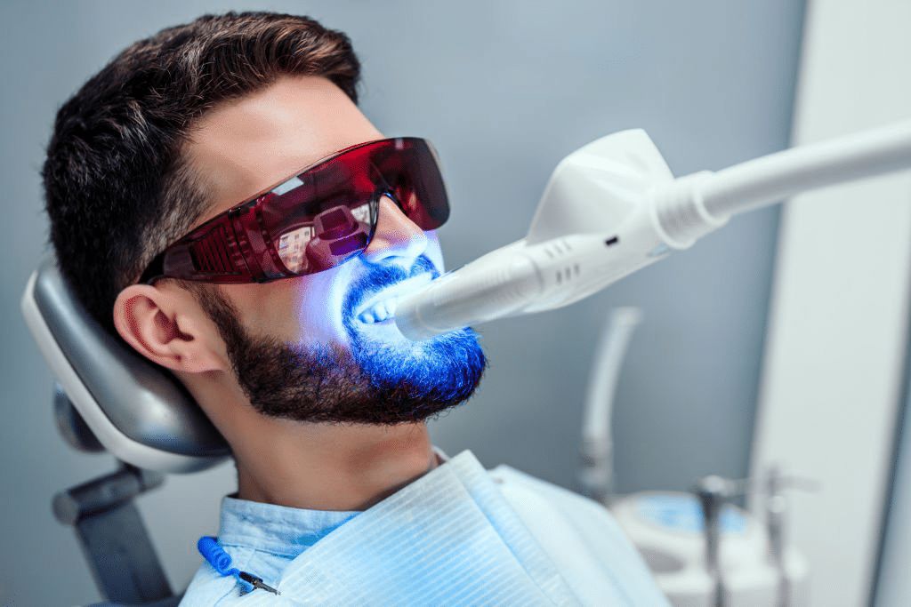 Професионално избелване на зъби с лазерна светлина в Smile Care